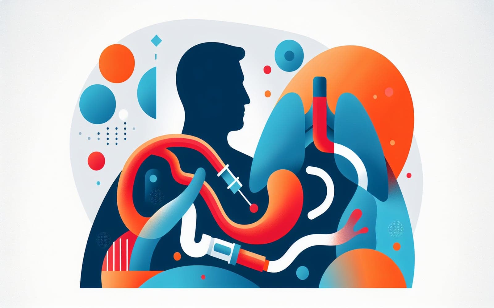 Endoscopic eradication therapy involves using techniques like radiofrequency ablation or endoscopic resection to remove or destroy abnormal esophageal tissue, reducing cancer risk.